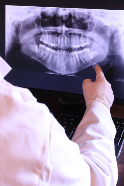 Best Dentist for Dental Trauma  in Wahpeton, ND