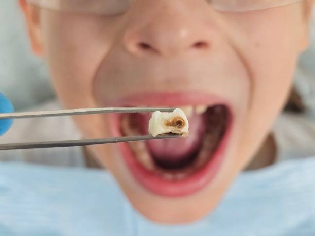 Dentist for Dental Trauma in ND